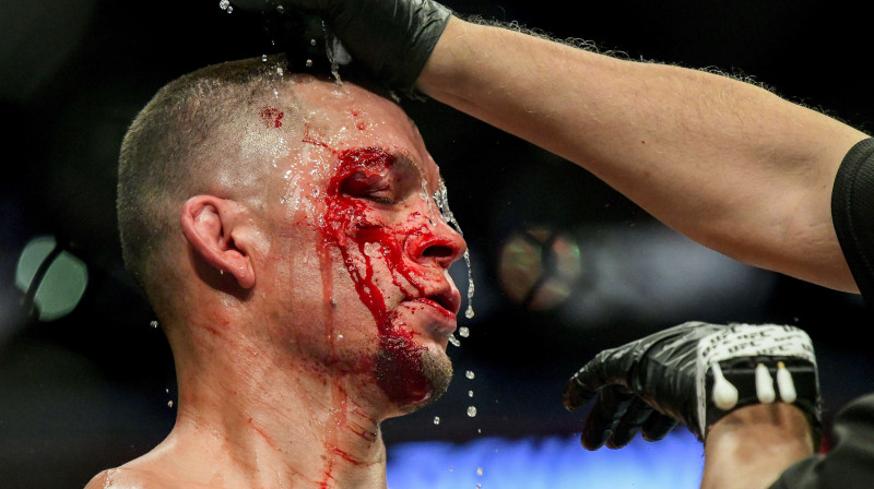 Neits Diazs sekundanta aprūpē. Foto: AFP/Scanpix