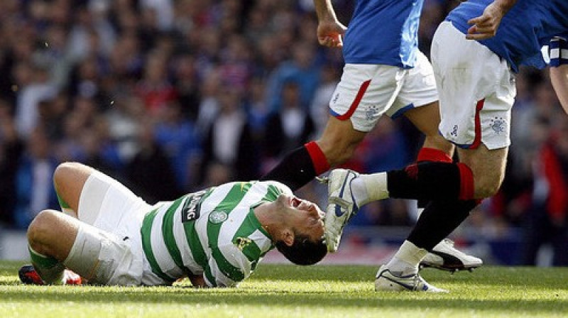"Celtic" šodien zaudēja
Foto: PA Wire