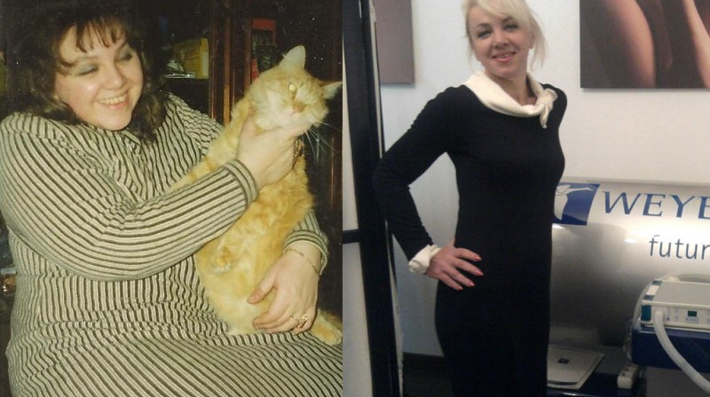 Tatjana, kas, ievērojot Hazāna diētu zaudēja 60 kg, palīdzību meklēja <b>WEYERGANS</b> veselības centrā, kur tika sastādīta individuāla programma tieši viņai.