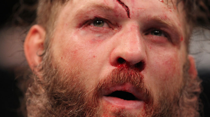 Rojs Nelsons pēc cīņas ar Fabricio Verdumu
Foto: ufc.com