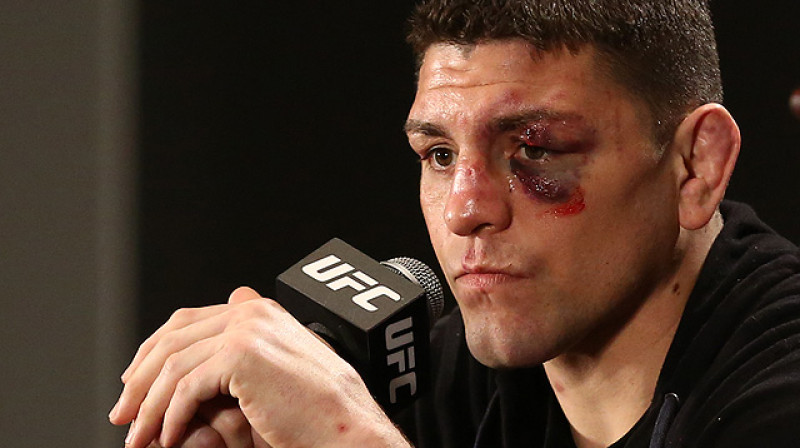 Niks Diazs
Foto: sherdog.com