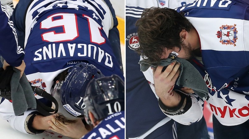 Kaspars Daugaviņš savainots 
Foto: hctorpedo.ru