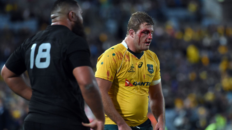 Vai Austrālijas regbijs apstādinās savu asiņošanu?
Foto: AFP/Scanpix