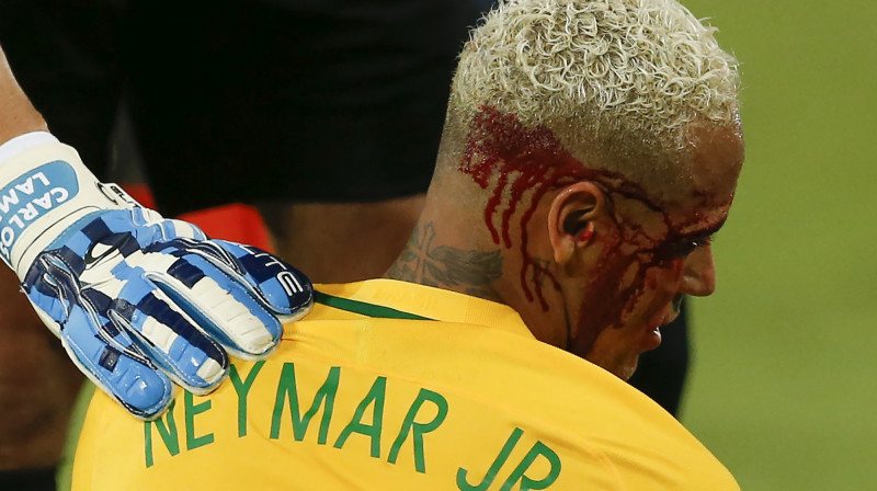 Neimārs pēc sāpīgas sadursmes
Foto: AP/Scanpix