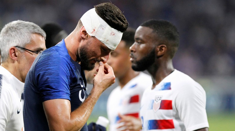 Olivjē Žirū ar 31 vārtiem 74 spēlēs ir ceturtais rezultatīvākais spēlētājs Francijas izlases vēsturē
Foto: Reuters/Scanpix