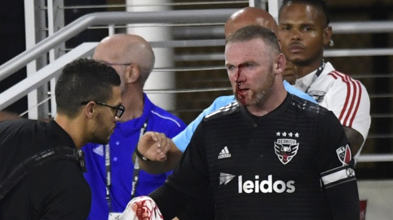 Veins Rūnijs
Foto: AP/Scanpix