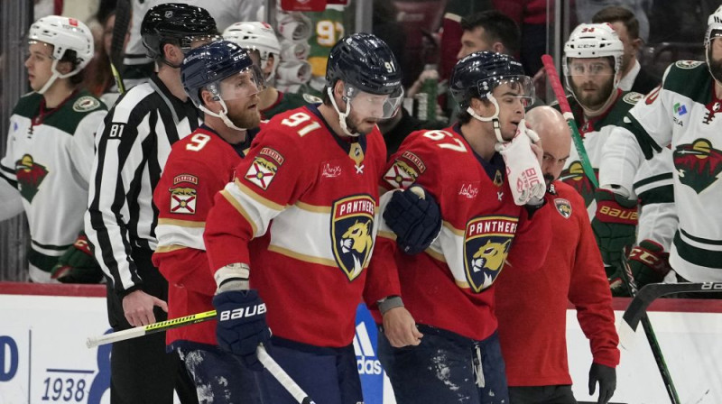 Viljams Lokvuds cietis pēc kautiņa. Foto: AP/Scanpix