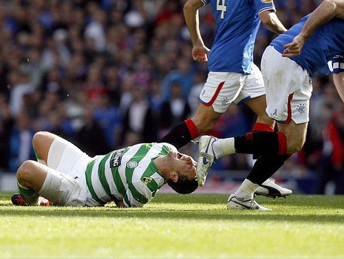 "Rangers" uzvar līderi "Celtic"