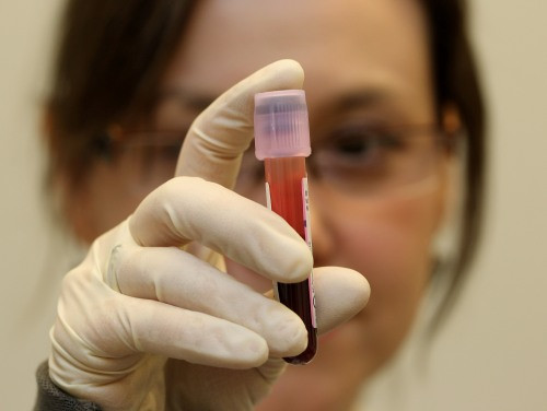 WADA: antidopinga laboratorija Maskavā ir neuzticama, tā jāslēdz