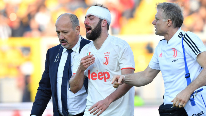 "Juventus" bez Ronaldu neuzvar pastarīti, tīnis gūst supervārtus no brīvsitiena